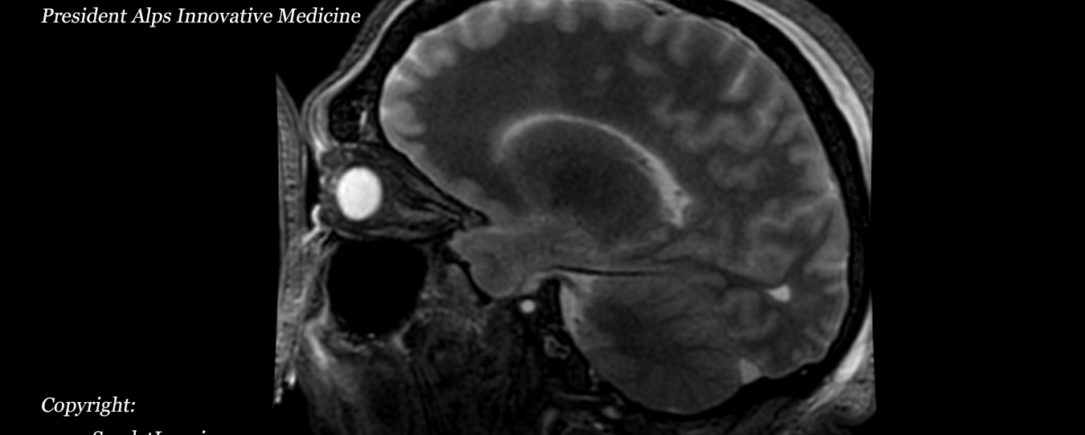 BriteVu contrast agent perfused human cadaver brain