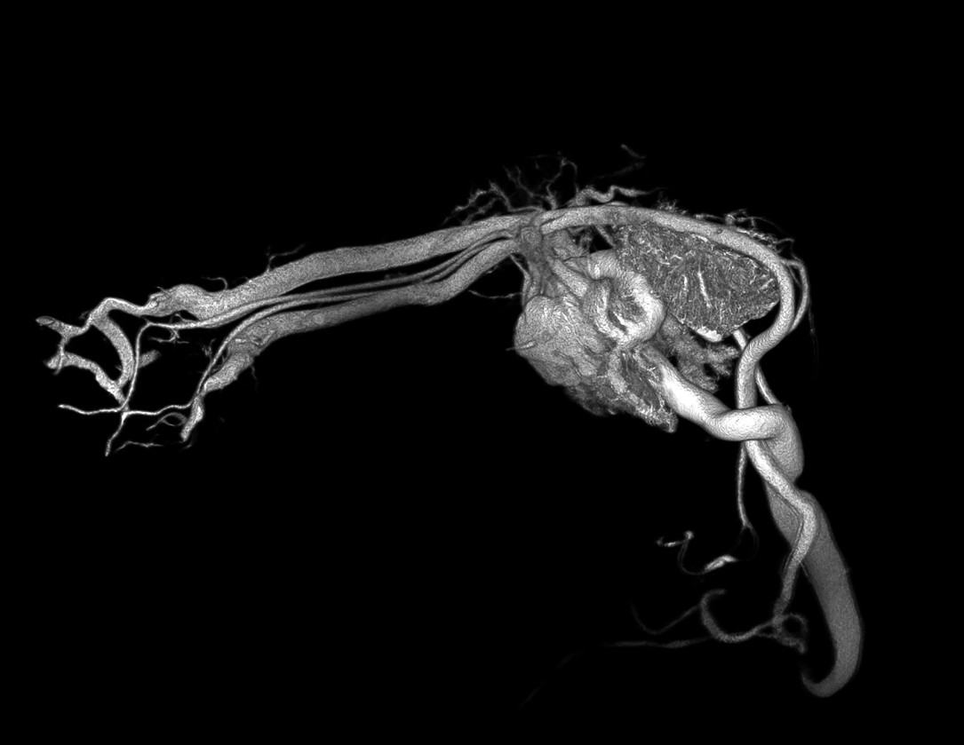 Chicken Embryo Perfused with BriteVu Contrast Media