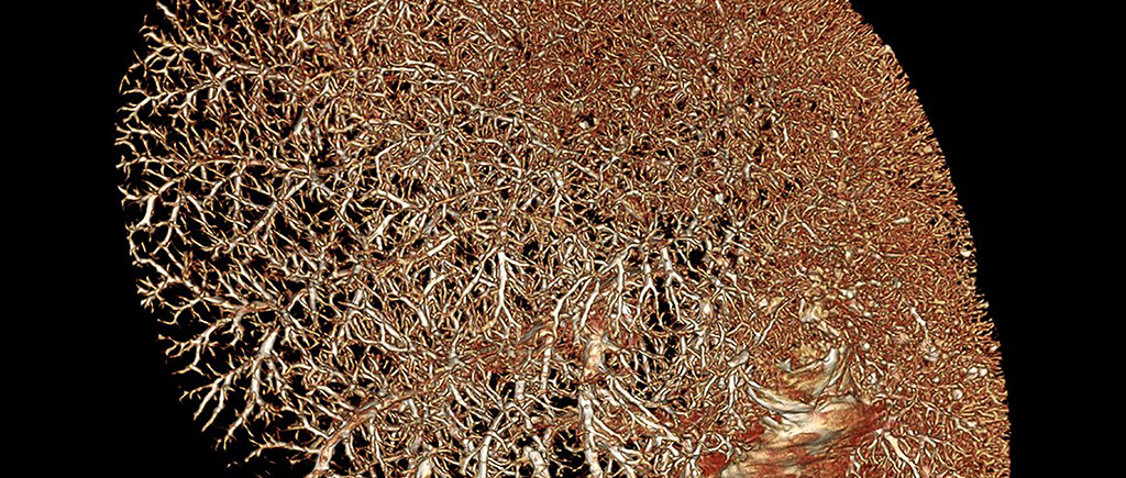 Macaw Liver Contrast CT Scan Using BriteVu