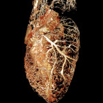 Rat heart perfused with BriteVu® contrast agent.