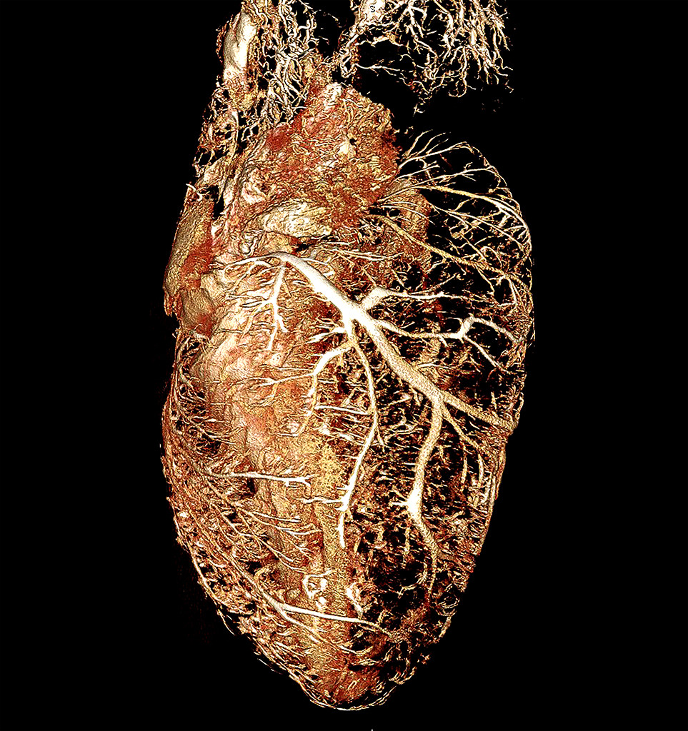 Rat Heart Perfused with BriteVu CT Contrast Agent BriteVu