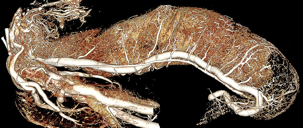 Alligator Distal Colon and Kidney Contrast Perfusion with BriteVu