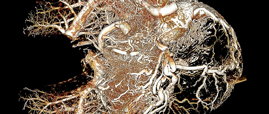 Alligator Stomach and Liver BriteVu Contrast Perfusion