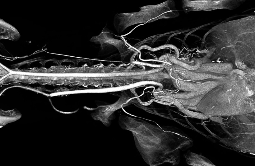 Alligator Neck and Heart High Radiodensity Contrast Perfusion with BriteVu