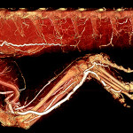 Mouse Liver Perfused with BriteVu + Metaflow
