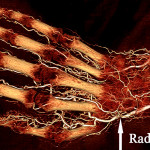 A human cadaver wrist and hand was perfused using BriteVu high radiodensity contrast agent.  