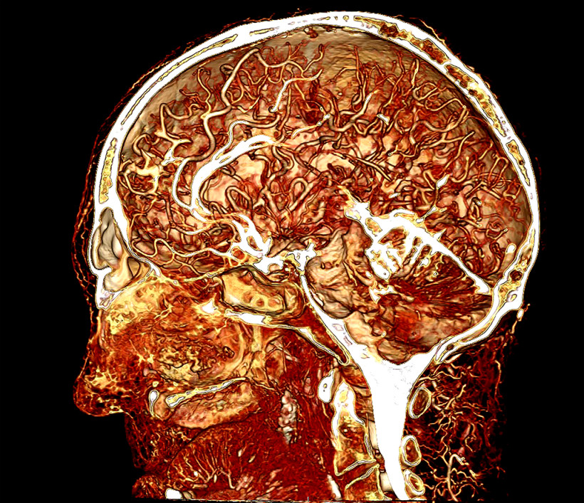 Contrast enhanced image of a human cadaver head