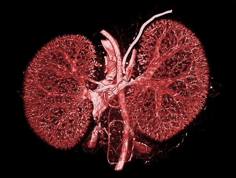 Contrast CT of Mouse Kidneys Perfused with BriteVu