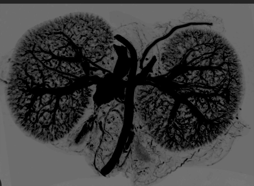 Contrast CT of Mouse Kidneys Perfused with BriteVu (Invert)