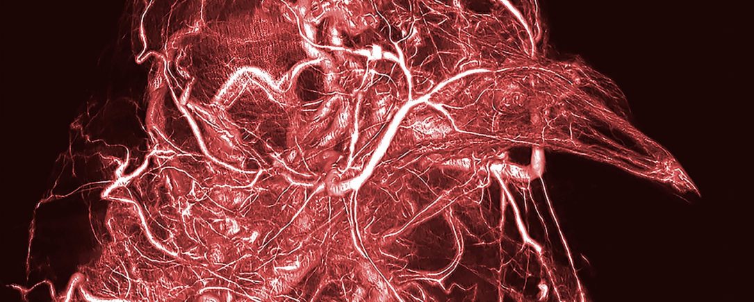 BriteVu Used to Create Award Winning Wellcome Images!!