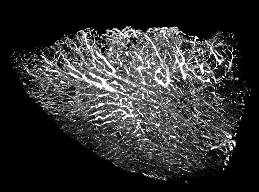 Pigeon Lung High Radiodensity Contrast Perfusion Using BriteVu