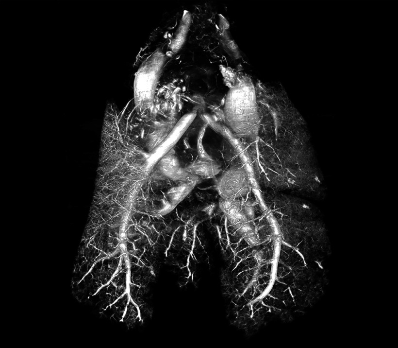 Rat Lungs Contrast CT Using BriteVu